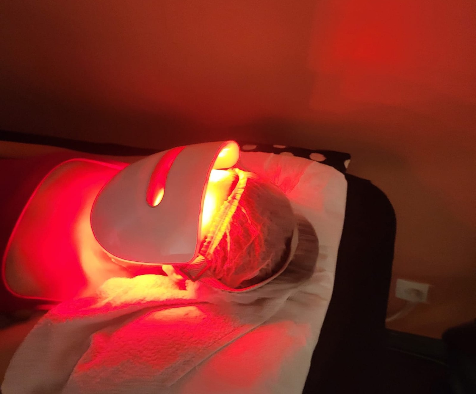 Quels sont les dangers de la radio fréquence sur le visage à Villeurbanne 60 dans le Rhône